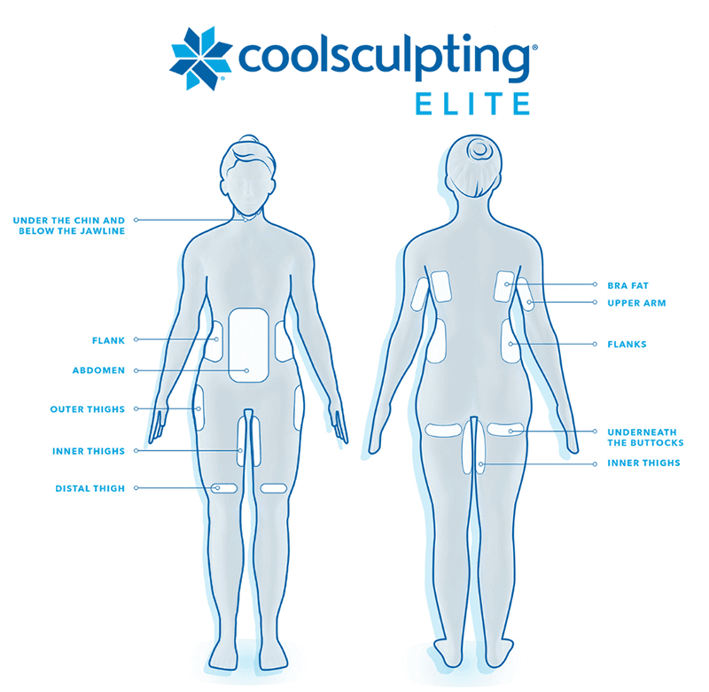 CoolSculpting® Elite - diagram